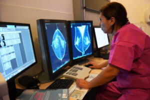 AI-driven Breast Cancer Detection